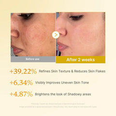 Medicube Kojic Acid Turmeric Resurfacing Toner 250ml